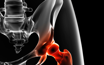 Can a Chiropractor Visit Help Ease SI Joint Inflammation